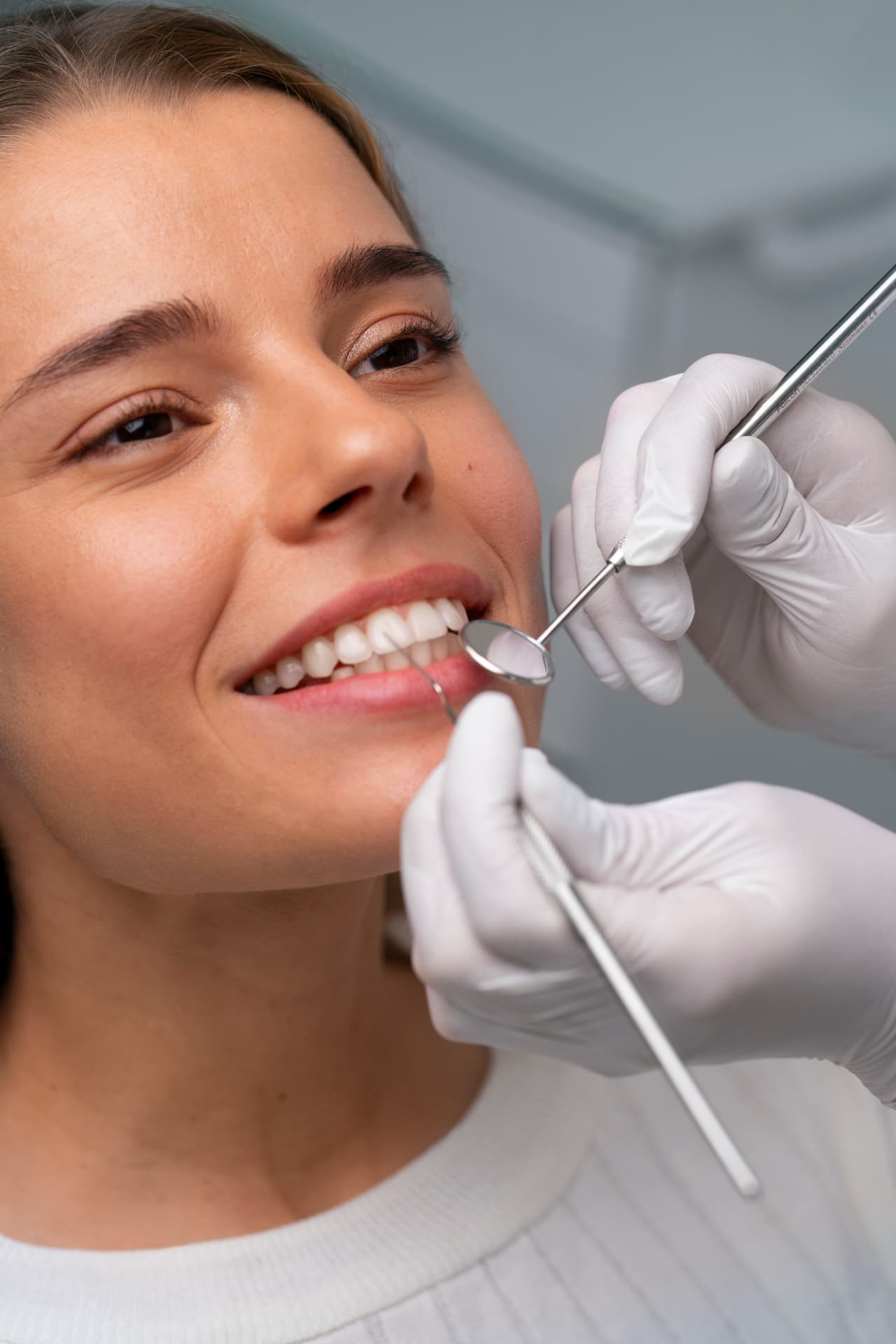 Facetas dentárias